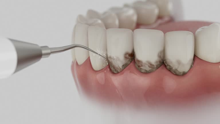 Trusted Tooth Extraction service in Grandview Plaza, KS - Dentist Open Now